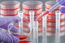 Stable Cell Line Generation