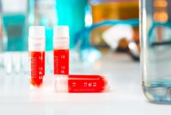 A549/IFN beta reporter (GFP) cell line 