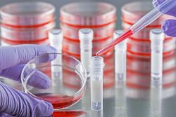 Stable Cell Line Generation