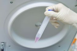 ViroGold lentivirus concentrator